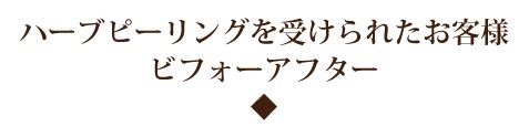 ハーブピーリングを受けられたお客様のビフォーアフター